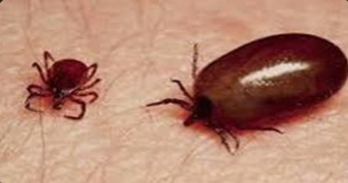 Breaking: IGMC में स्क्रब टायफस से दो मरीजों की मौत