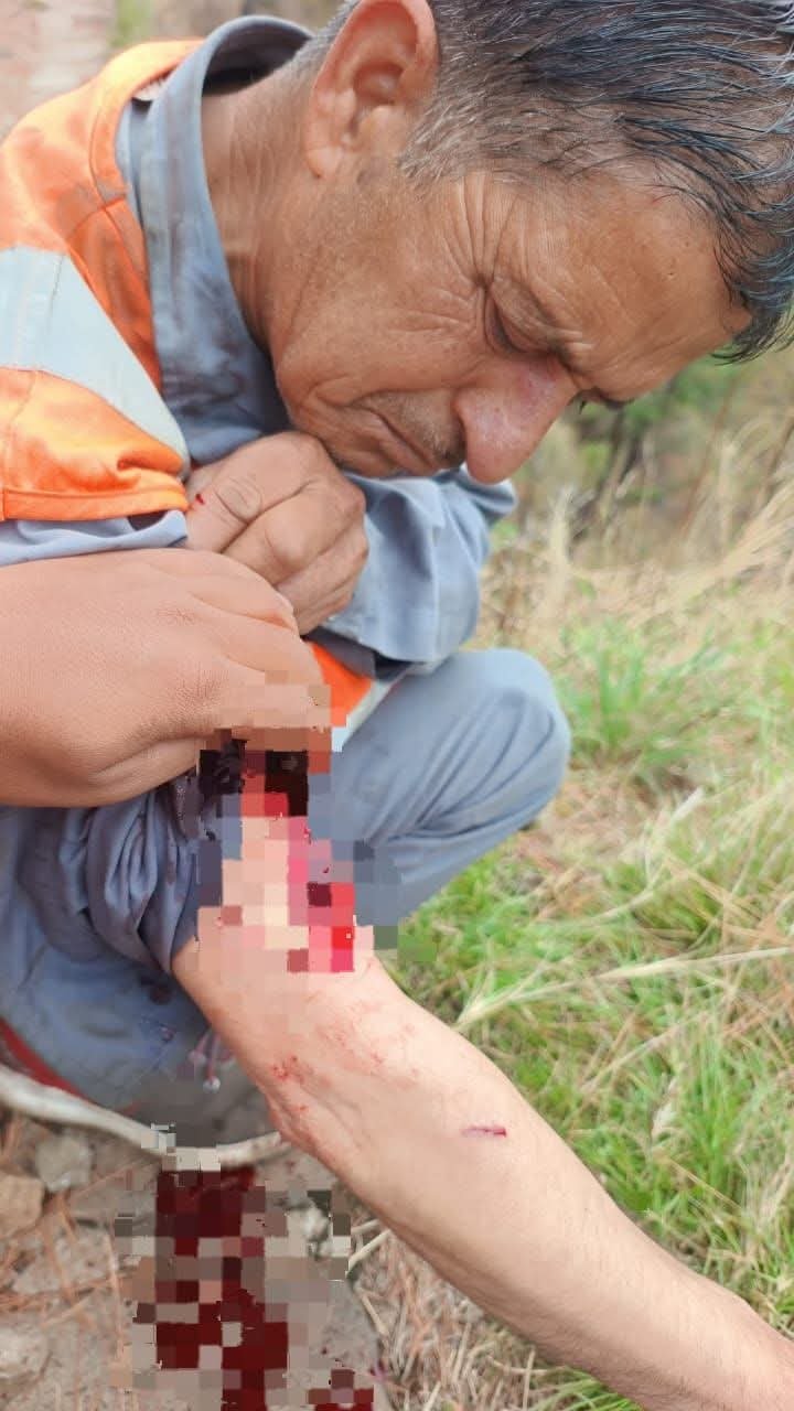 Breaking: शिमला में कुत्तों बंदरों के आतंक के बाद लंगूरों का आतंक एक व्यक्ति को काटा